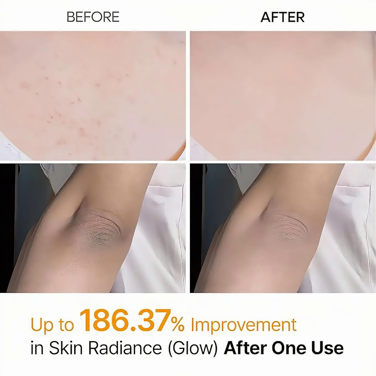 Dr. Melaxin Peel Shot – Kojic Acid Exfoliating Body & Foot Spray